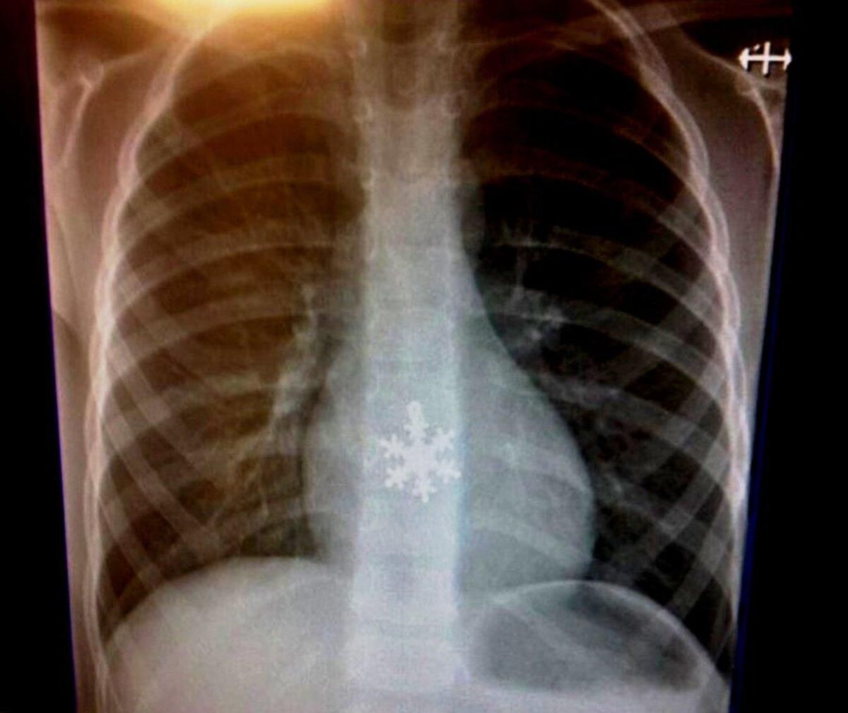 Неожиданные рентгеновские снимки Неожиданные рентгеновские снимки